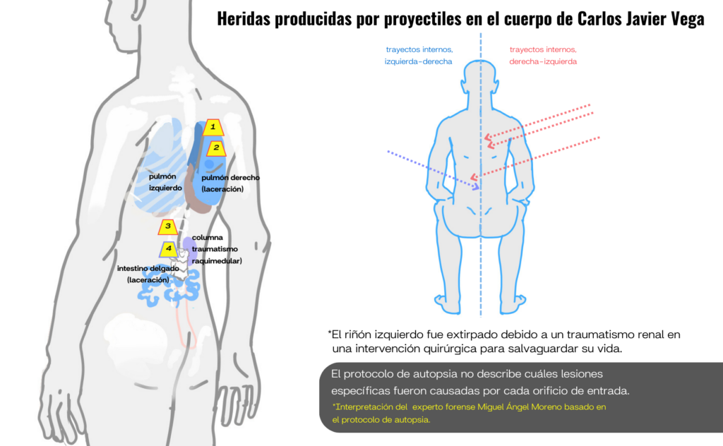 Heridas descritas por el médico legista. Infografía de Axpel.